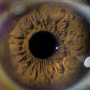 Blood and Guts: Plucking out your eyeballs